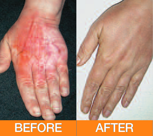 advance 7 pain relief