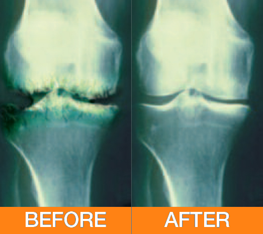 advance 7 pain relief