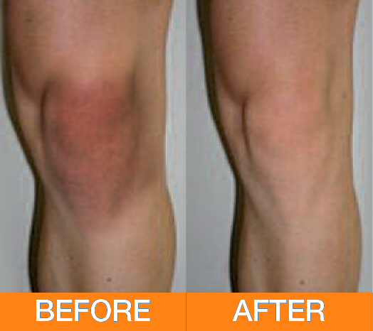 advance 7 pain relief